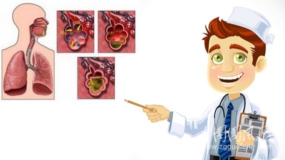 肺氣腫吃什么好