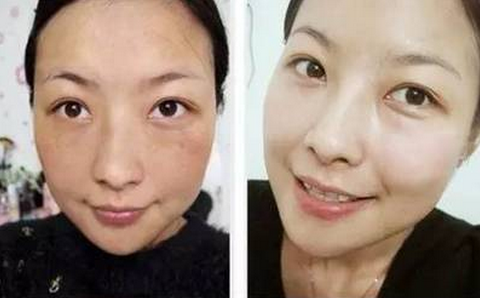 祖?zhèn)髅胤剑?天祛斑去皺，40歲大嫂逆齡20歲
