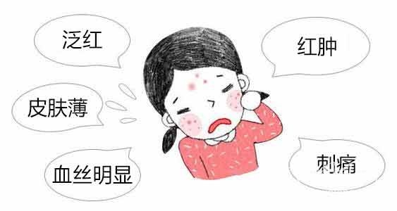 怎樣消除煩人紅血絲 這些方法讓你輕松消除