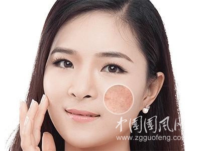 女人常玩手機容易長斑？告訴你3個淡斑好方法